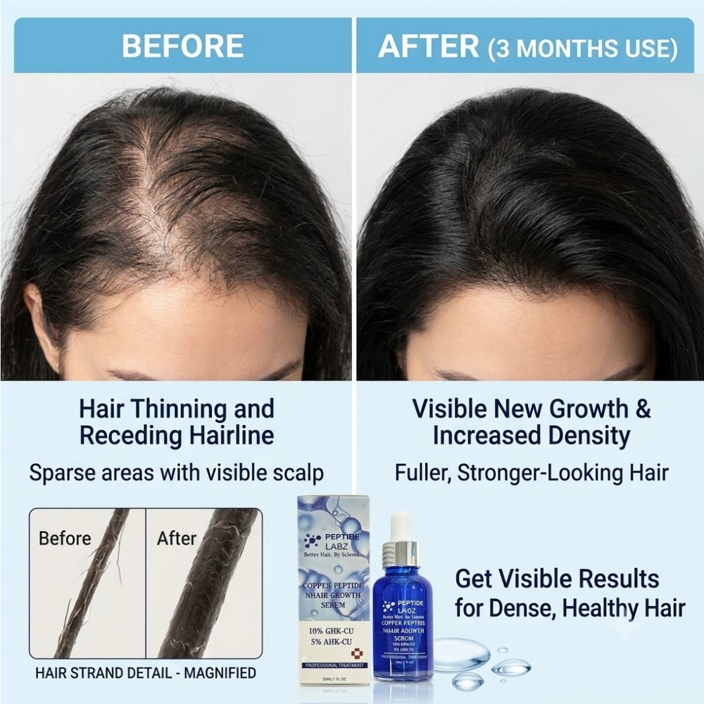 Essence de croissance des chev - Peptide Complex Serum avis et prix
