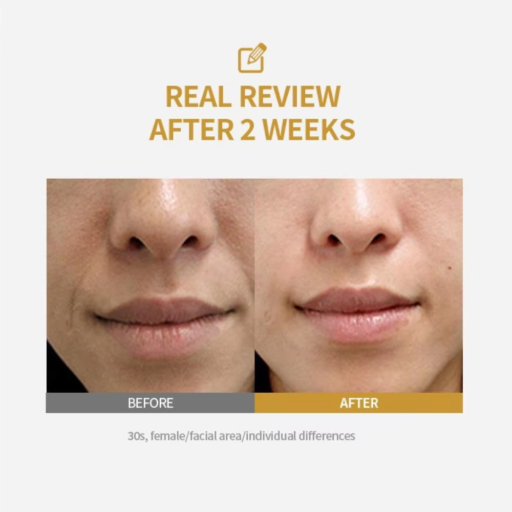 Ampoule Peptidique Liftante In - Peptide Complex Serum avis et prix